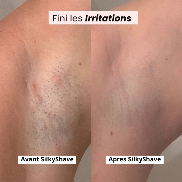 SilkyShave™ – Le rasoir sans douleur pour une peau douce en un seul passage