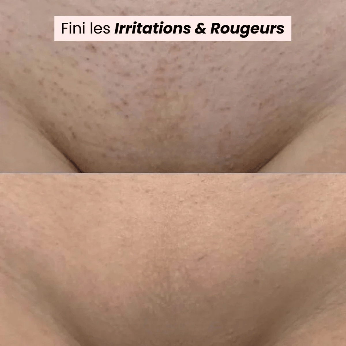 SilkyShave™ – Le rasoir doux pour une peau lisse sans irritation