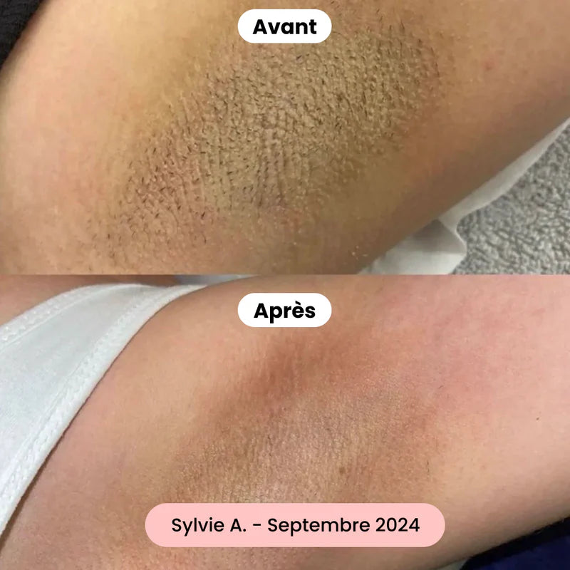 SilkyShave™ – Le rasoir doux pour une peau lisse sans irritation